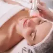 RADIOFRECUENCIA FACIAL